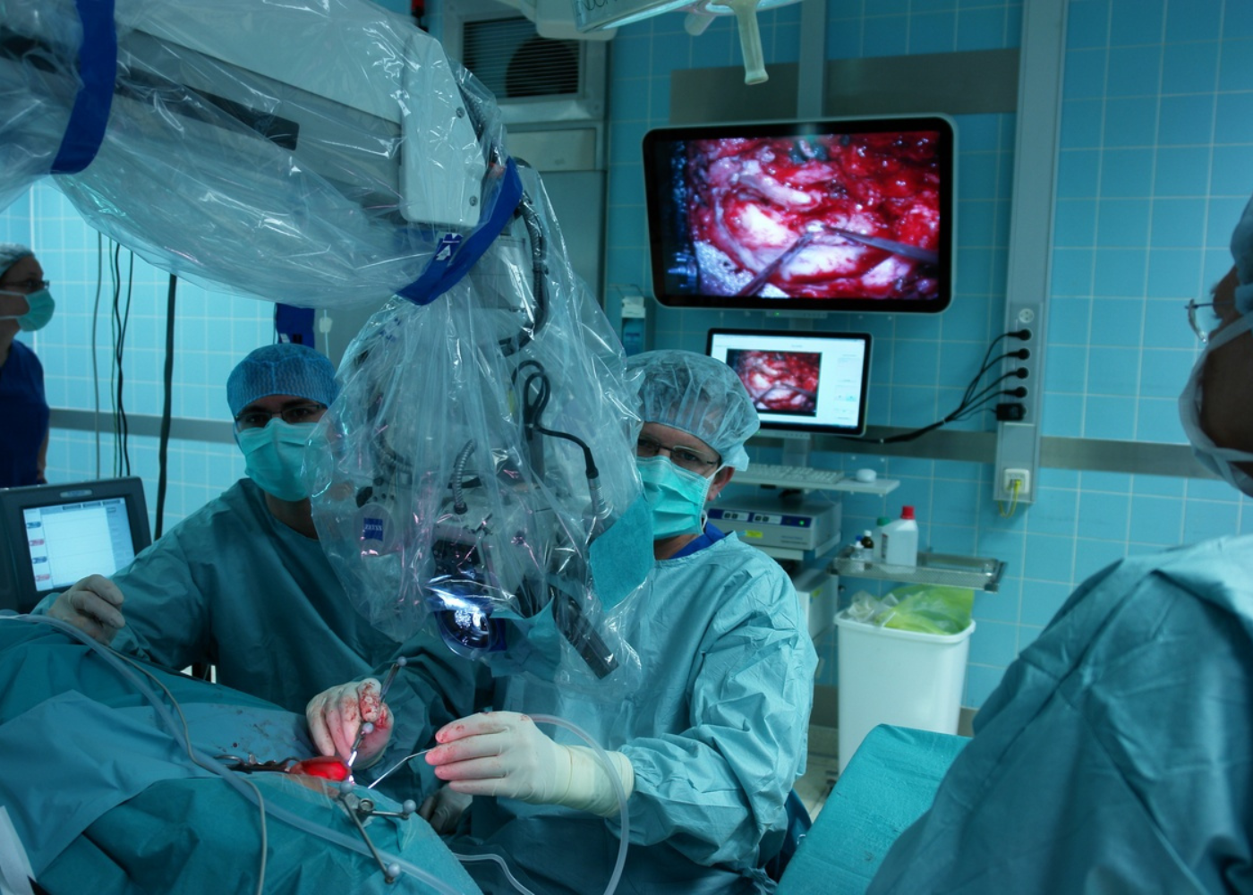 Microvascular Decompression Surgery (Long-Term Solution)