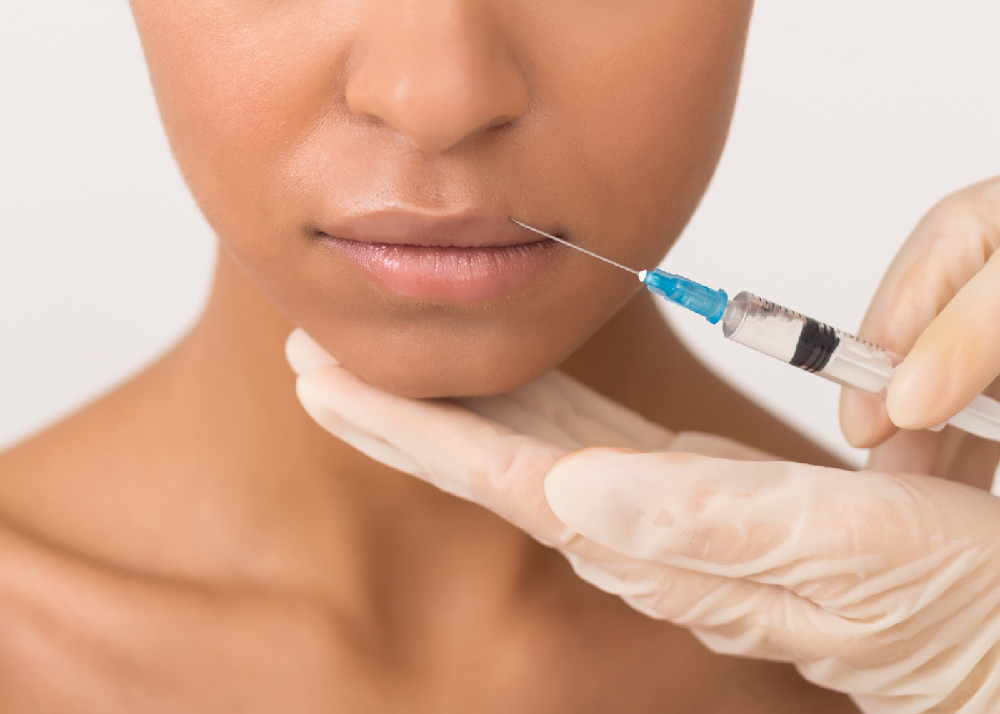 Lip Lift Surgery
