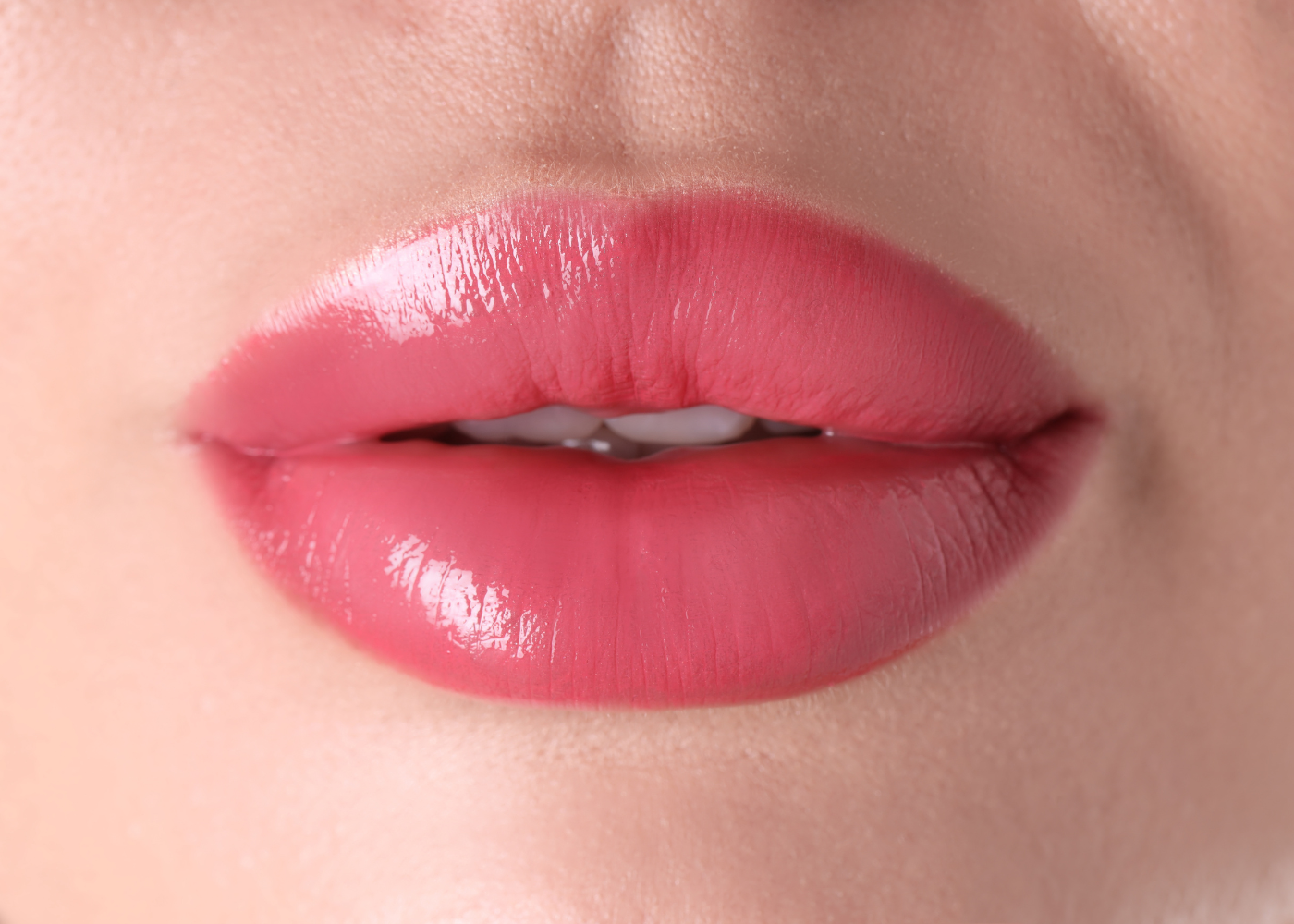 Lip Lift Surgery in Bangalore
