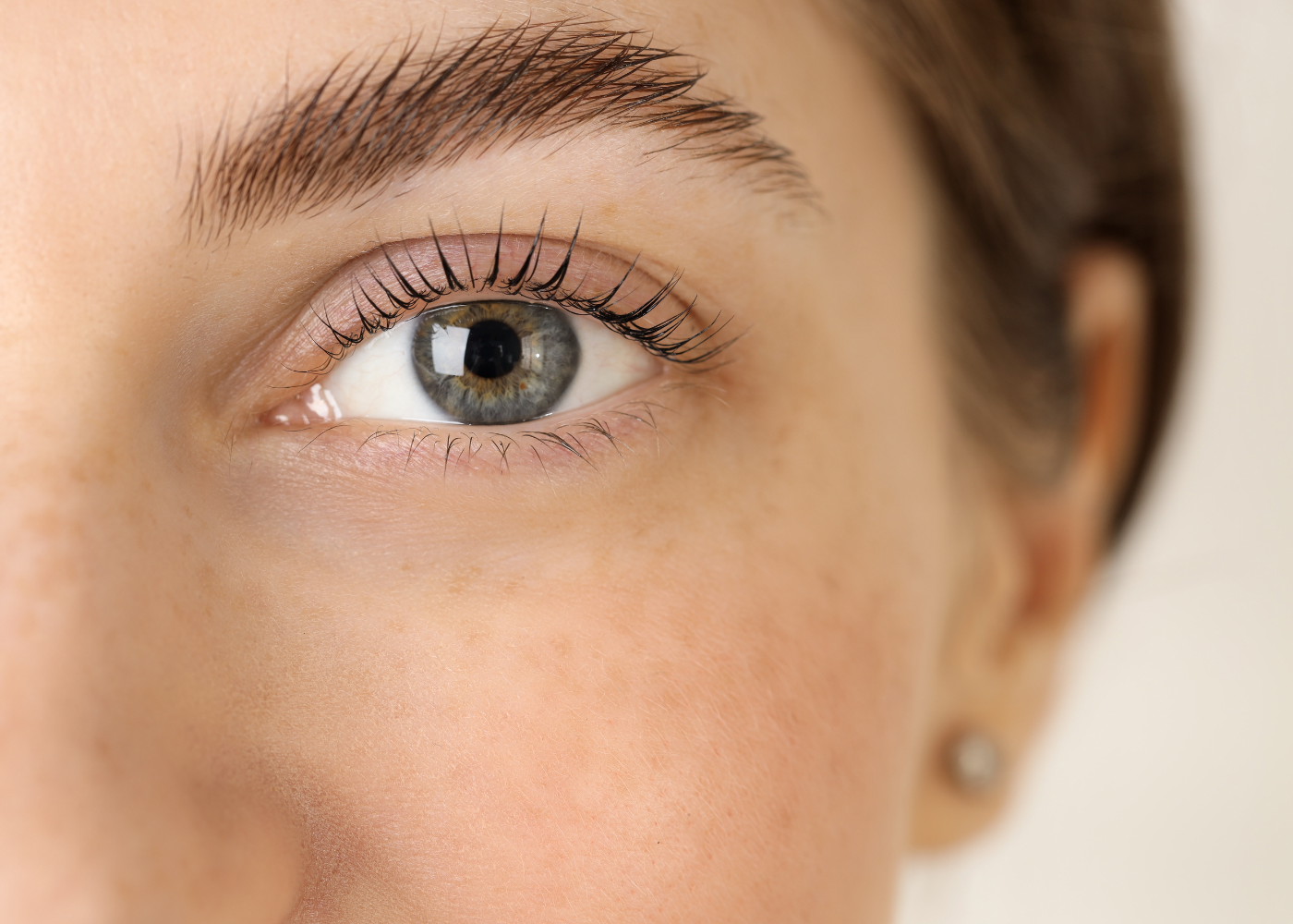 Temporal Brow Lift in Bangalore