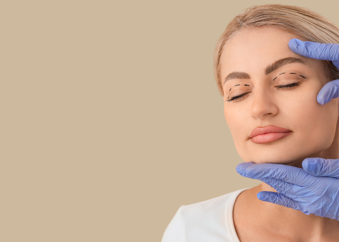 Temporal Brow Lift in Bangalore