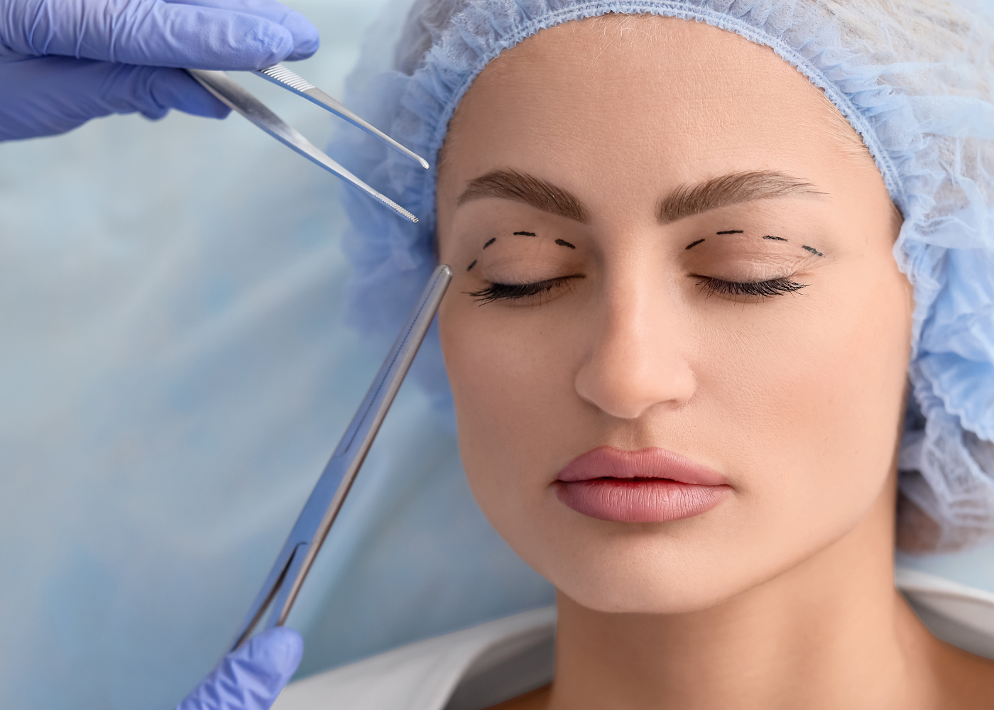 Surgical Temporal Brow Lift
