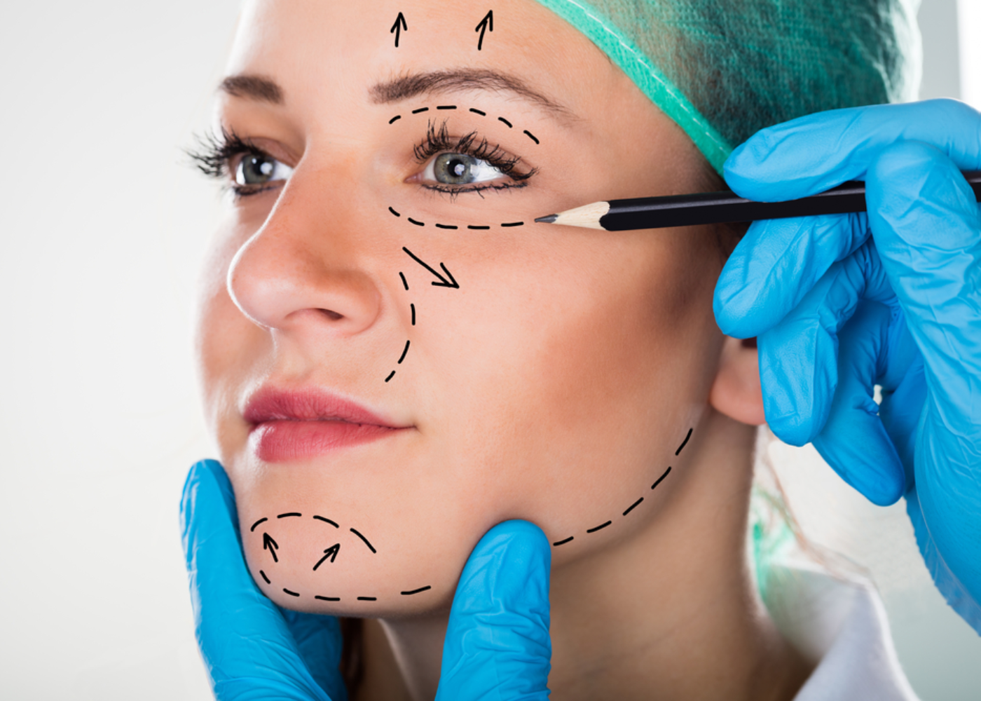 Mid Cheek Lift in Bangalore