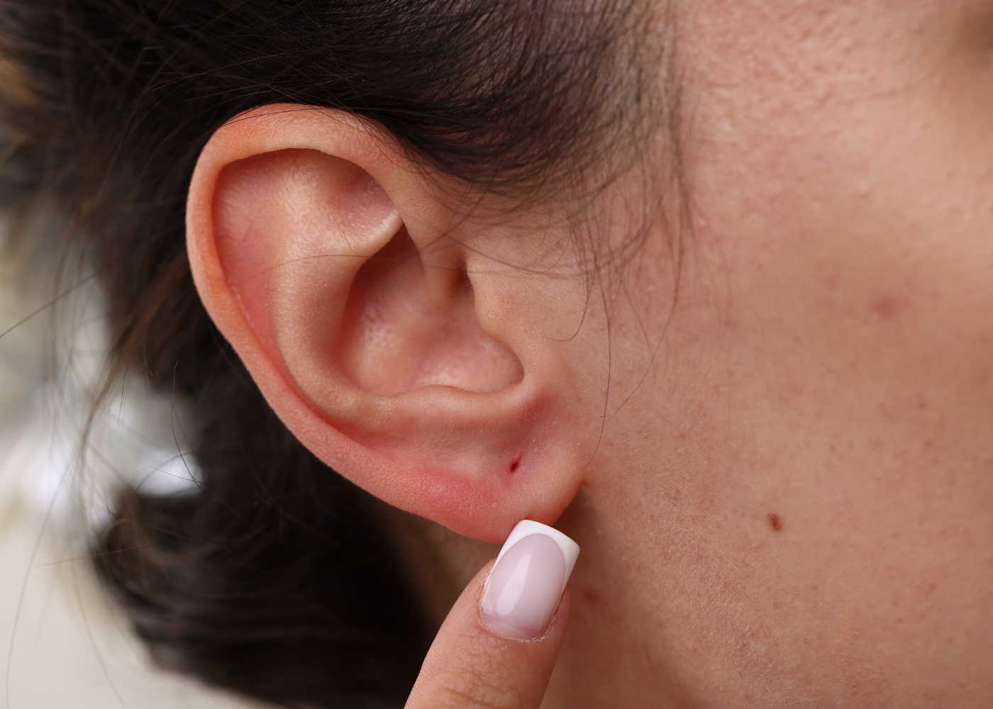 Earlobe Repair