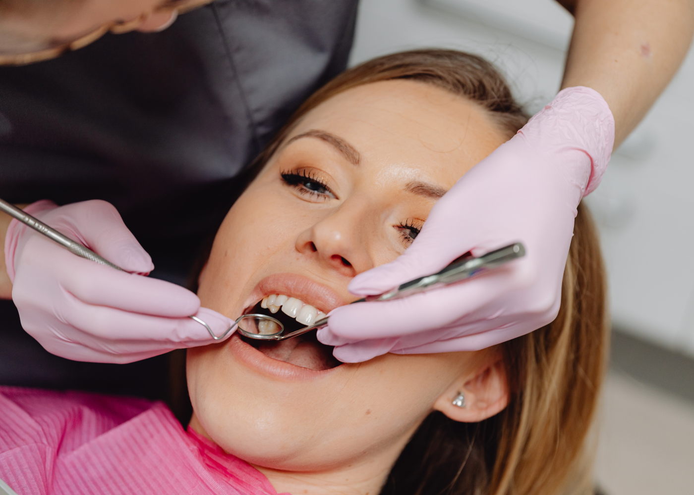Tooth Removal
