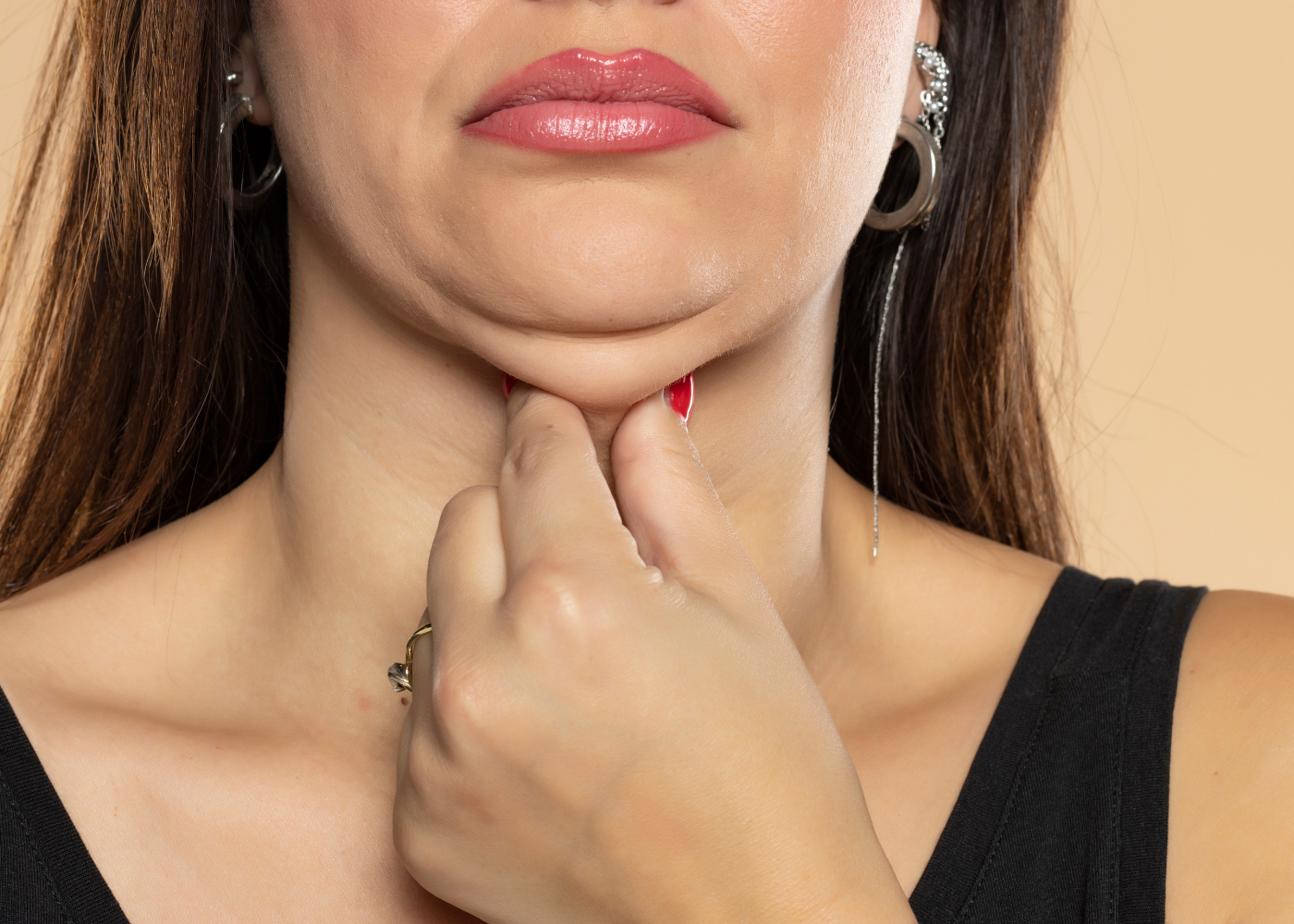 Chin Liposuction