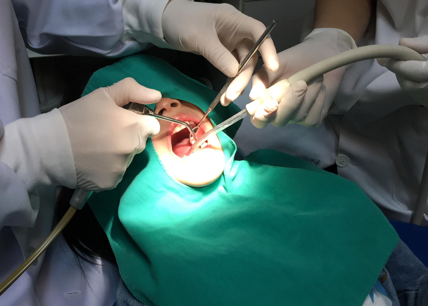 Surgical Tooth Extraction