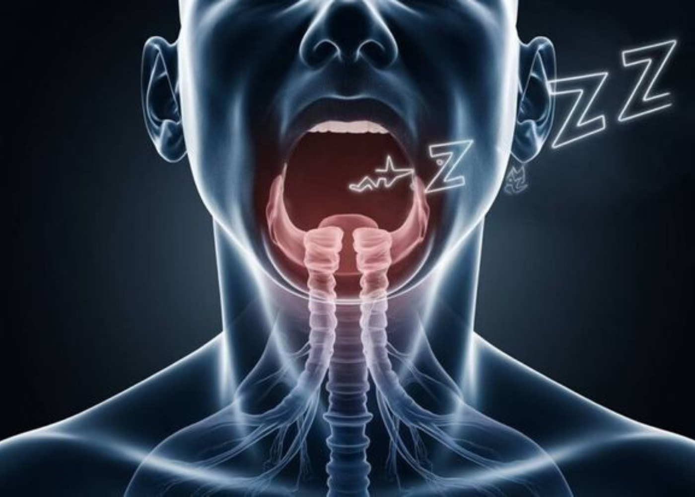 What is Sleep Apnea Correction?