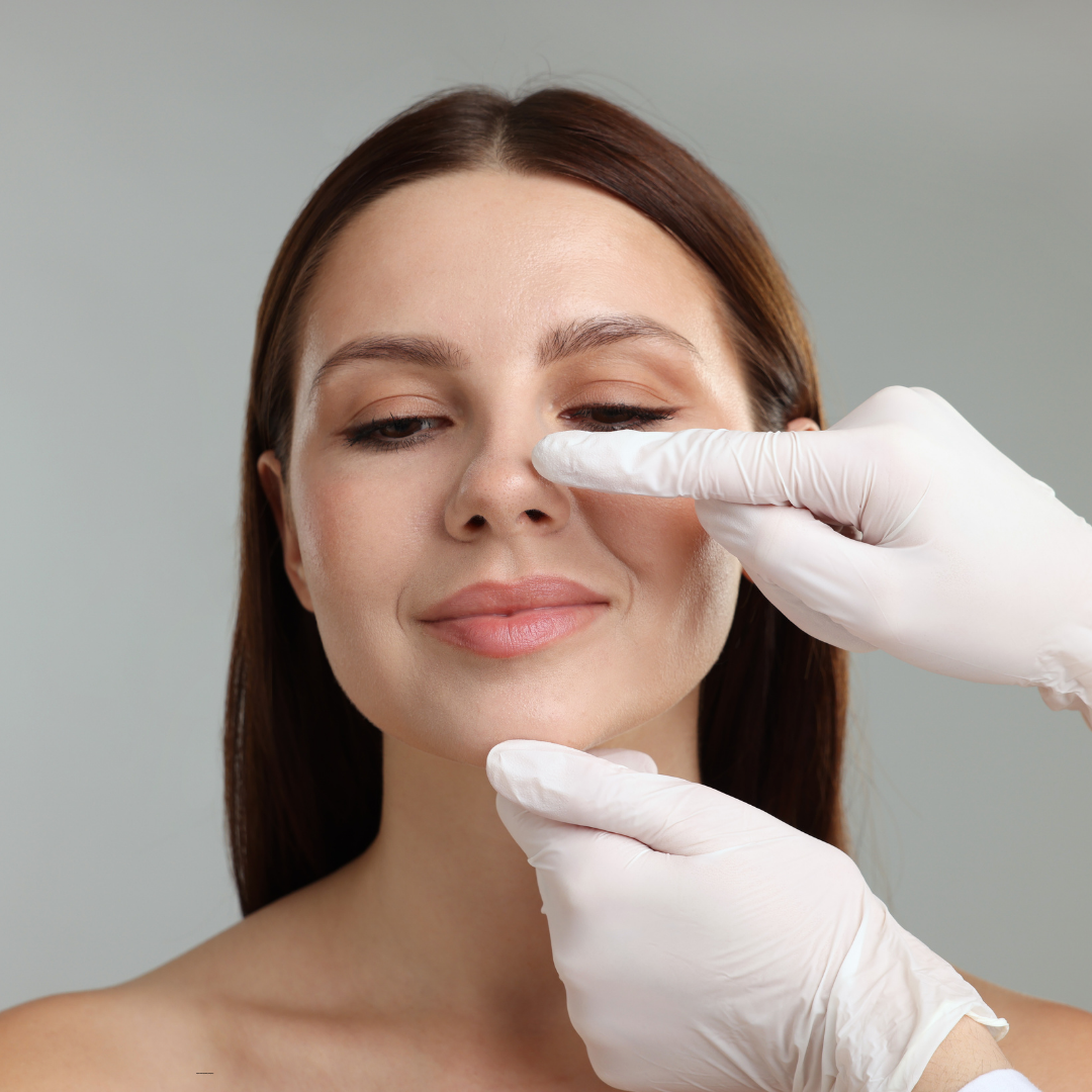 open rhinoplasty in Bangalore